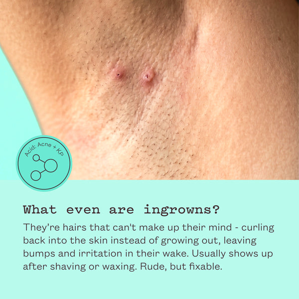 Close-up of ingrown hairs on an underarm. Text reads: What even are ingrowns? They're hairs that can't make up their mind, curling back into the skin instead of growing out, leaving bumps and irritation in their wake. Usually shows up after shaving or waxing. Rude, but fixable.