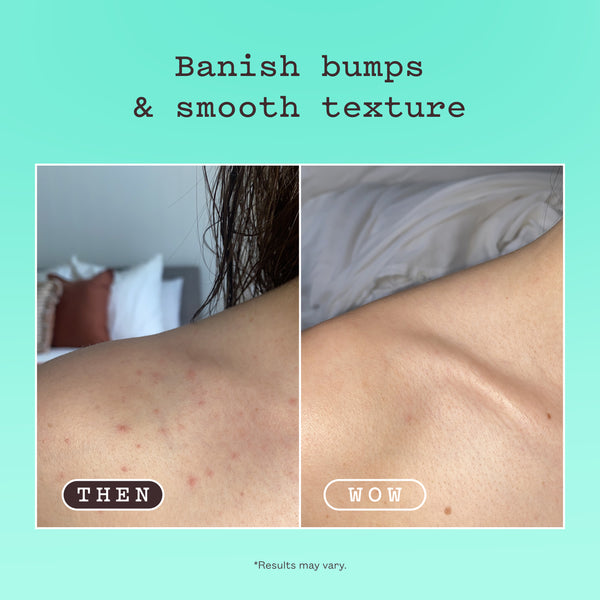 Glycolic Body Scrub